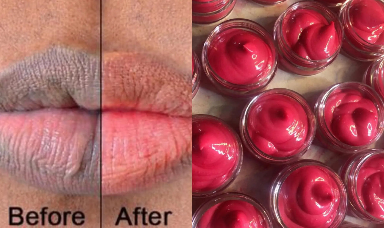Lip Lightening Balm