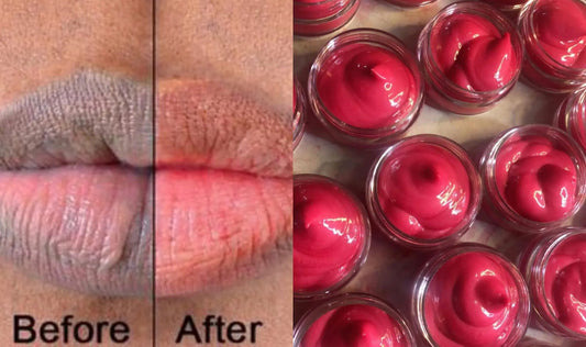 Lip Lightening Balm